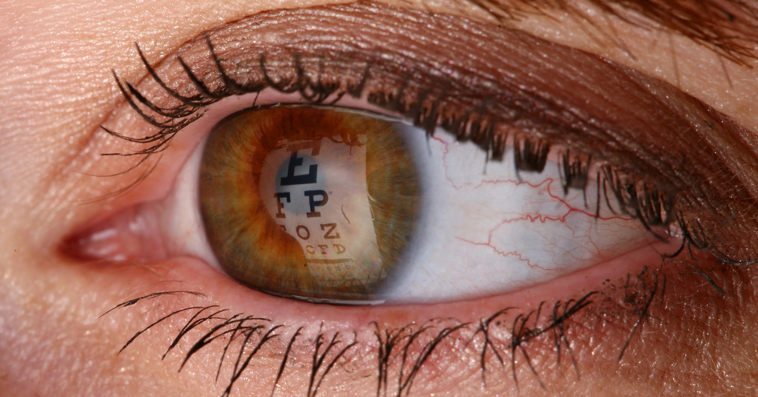 Eye-opening pictures shine light on symptoms of astigmatism
